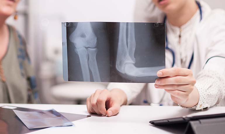 diagnosis of osteoporosis